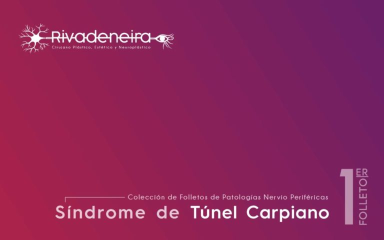 Síndrome-de-Túnel-Carpiano-pdf-1024x640